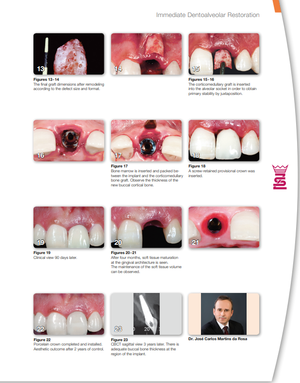 Kit (IDR) Dr Da Rosa - Helmut Zepf (41.550.00) - Delynov