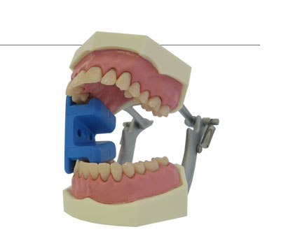 Ouvre-bouche en silicone (2 pièces) - Delynov - Helmut Zepf (37.258.40) - Delynov